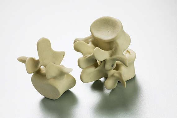 3D Printed Spinal Vertebrae